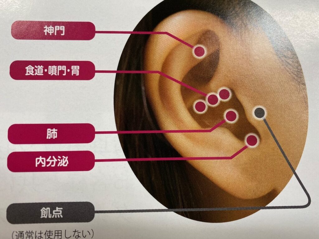 e880b3e381a4e381bce38380e382a4e382a8e38383e38388e381afe38184e3818fe38289e3818be3818be3828befbc9fe69699e98791e381aee8a9b3e7b4b0e8a7a3 耳つぼダイエットはいくらかかる?料金の詳細解説